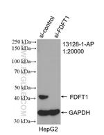 FDFT1 Antibody in Western Blot (WB)