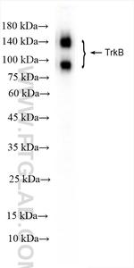 TrkB Antibody in Western Blot (WB)