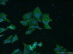 TrkB Antibody in Immunocytochemistry (ICC/IF)
