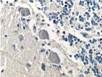 TrkB Antibody in Immunohistochemistry (Paraffin) (IHC (P))