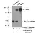TrkB Antibody in Immunoprecipitation (IP)