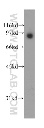 TrkB Antibody in Western Blot (WB)