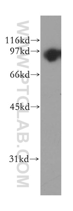 TrkB Antibody in Western Blot (WB)