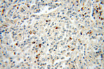 TRAV20 Antibody in Immunohistochemistry (Paraffin) (IHC (P))