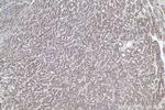 ULBP2 Antibody in Immunohistochemistry (Paraffin) (IHC (P))