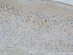 MINK1 Antibody in Immunohistochemistry (Paraffin) (IHC (P))