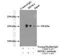 MINK1 Antibody in Immunoprecipitation (IP)