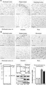 Tau Antibody in Western Blot, Immunohistochemistry (WB, IHC)
