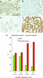 Tau Antibody in Immunohistochemistry (IHC)