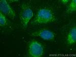 FGD1 Antibody in Immunocytochemistry (ICC/IF)