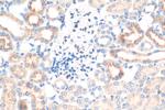 FGD1 Antibody in Immunohistochemistry (Paraffin) (IHC (P))
