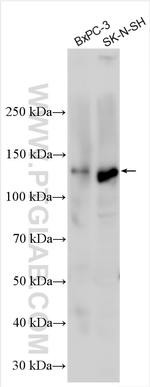 FGD1 Antibody in Western Blot (WB)