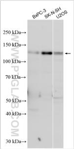 FGD1 Antibody in Western Blot (WB)