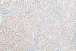 PLS1 Antibody in Immunohistochemistry (Paraffin) (IHC (P))