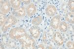 PLS1 Antibody in Immunohistochemistry (Paraffin) (IHC (P))
