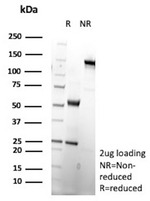 CD200 Receptor 1 (CD200R1)/OX2 Antibody in SDS-PAGE (SDS-PAGE)