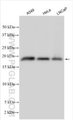 POP5 Antibody in Western Blot (WB)
