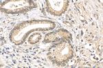 FOXM1 Antibody in Immunohistochemistry (Paraffin) (IHC (P))