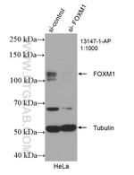 FOXM1 Antibody in Western Blot (WB)