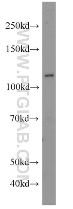 FOXM1 Antibody in Western Blot (WB)