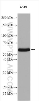 ZC3HC1 Antibody in Western Blot (WB)