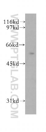ZC3HC1 Antibody in Western Blot (WB)