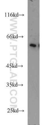 ZC3HC1 Antibody in Western Blot (WB)