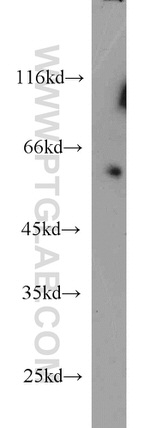 ZC3HC1 Antibody in Western Blot (WB)