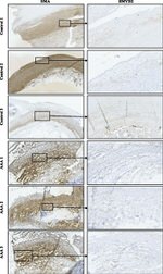 SMYD2 Antibody in Immunohistochemistry (IHC)