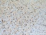 GDAP1 Antibody in Immunohistochemistry (Paraffin) (IHC (P))