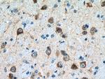 GDAP1 Antibody in Immunohistochemistry (Paraffin) (IHC (P))