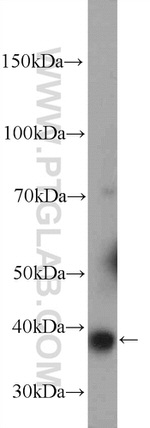 GDAP1 Antibody in Western Blot (WB)