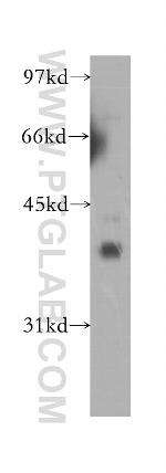 GDAP1 Antibody in Western Blot (WB)