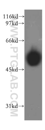 IP6K2 Antibody in Western Blot (WB)
