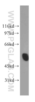 IP6K2 Antibody in Western Blot (WB)
