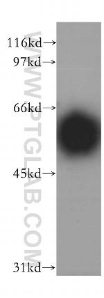 IP6K2 Antibody in Western Blot (WB)