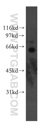KLF12 Antibody in Western Blot (WB)