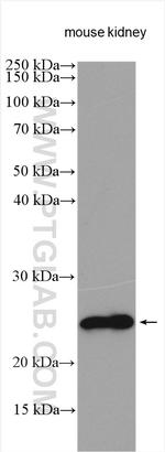 DNAJB9 Antibody in Western Blot (WB)