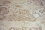DHX36 Antibody in Immunohistochemistry (Paraffin) (IHC (P))