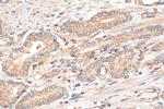 DHX36 Antibody in Immunohistochemistry (Paraffin) (IHC (P))