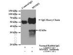 MYOZ1 Antibody in Immunoprecipitation (IP)