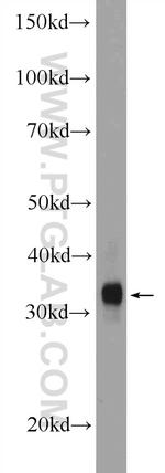 MYOZ1 Antibody in Western Blot (WB)