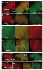 Ubiquitin Antibody in Immunohistochemistry (IHC)