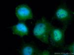 SIRT1 Antibody in Immunocytochemistry (ICC/IF)