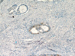 RASGRP3 Antibody in Immunohistochemistry (Paraffin) (IHC (P))