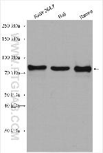 RASGRP3 Antibody in Western Blot (WB)