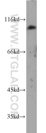 PSMA/GCPII Antibody in Western Blot (WB)