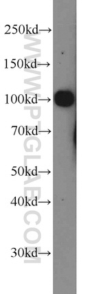 PSMA/GCPII Antibody in Western Blot (WB)