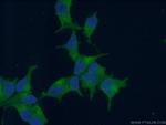 PSMA/GCPII Antibody in Immunocytochemistry (ICC/IF)