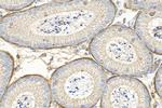 SLC26A3 Antibody in Immunohistochemistry (Paraffin) (IHC (P))